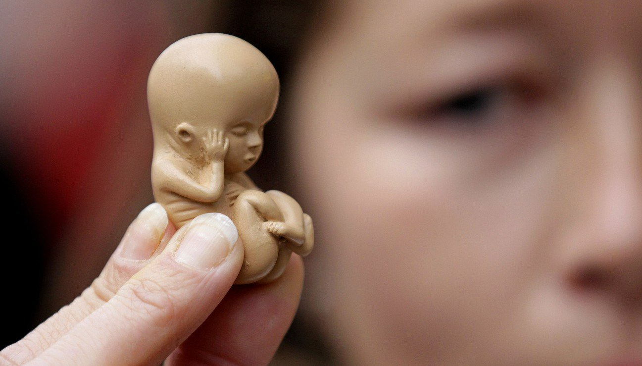 Frauen in der Schweiz treiben um über ein Sechstel häufiger ab als noch sieben Jahre zuvor. Bild: Keystone