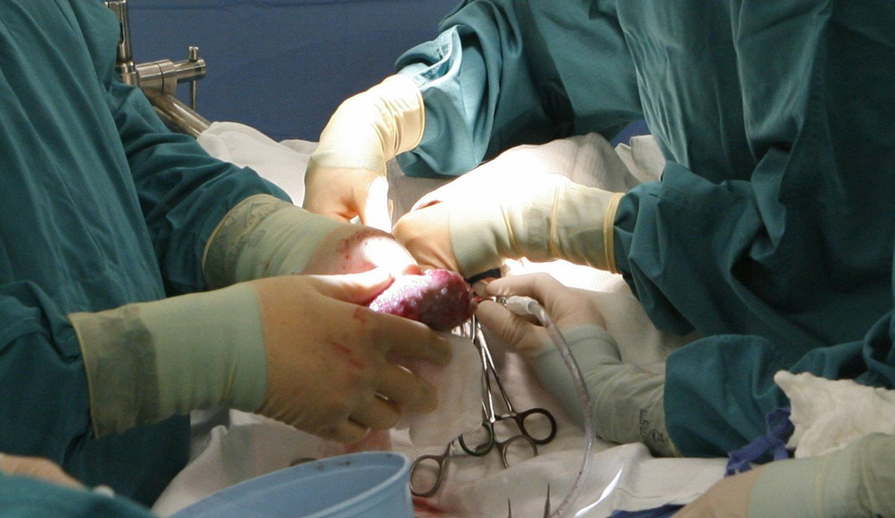 Fünf Minuten, um zu sterben: Transplantation einer Niere. Bild: Keystone