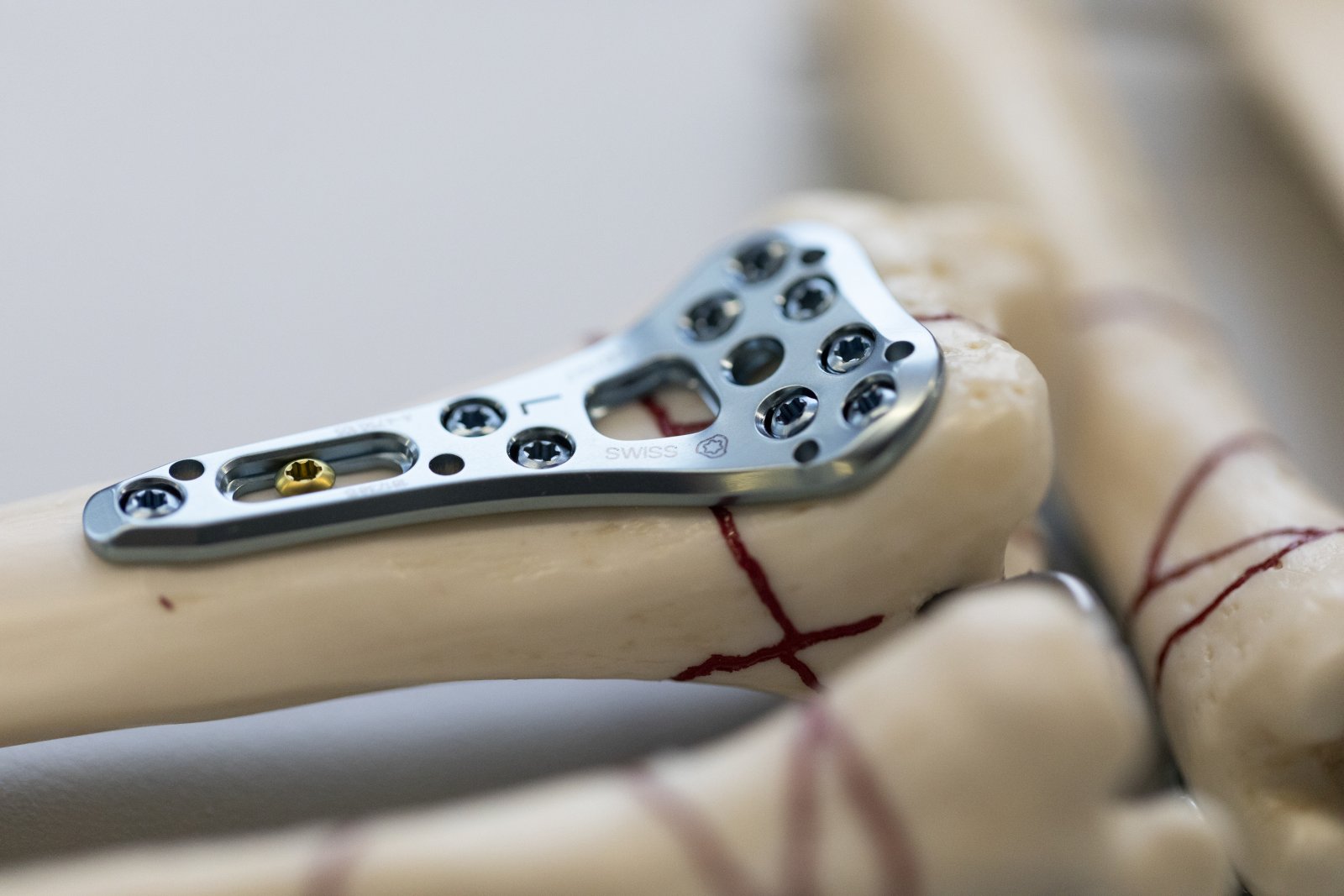 Die Mehrheit der Schweizer Medtech-Unternehmen hat sich rasch an die neue Situation angepasst (Bild: Gaetan Bally, Keystone-sda)