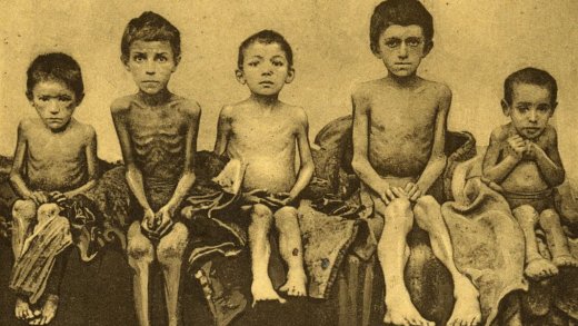 Stark unterernährte Kinder in der Ukraine Anfang der 1930er Jahre.